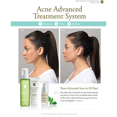 Nieuwsbrief - Acne Advanced Collectie