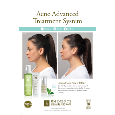 Poster — Acne Advanced Collectie Before & After