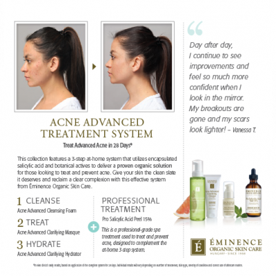 Shelf Talker — Before & After Flip Book V8